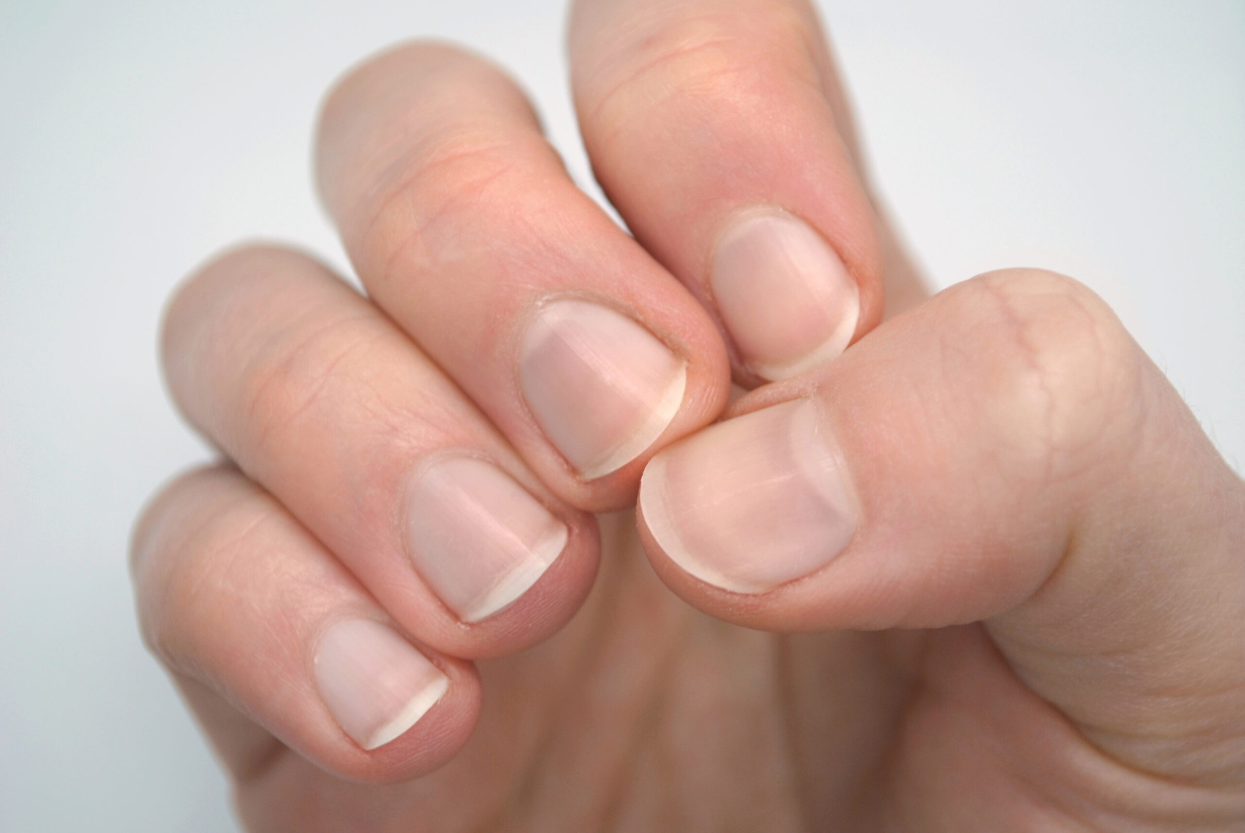 Image for article: Dr Karl nails down the facts about fingernails